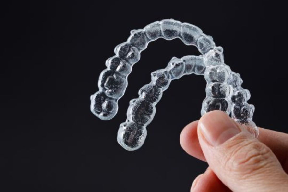 invisalign in silver spring