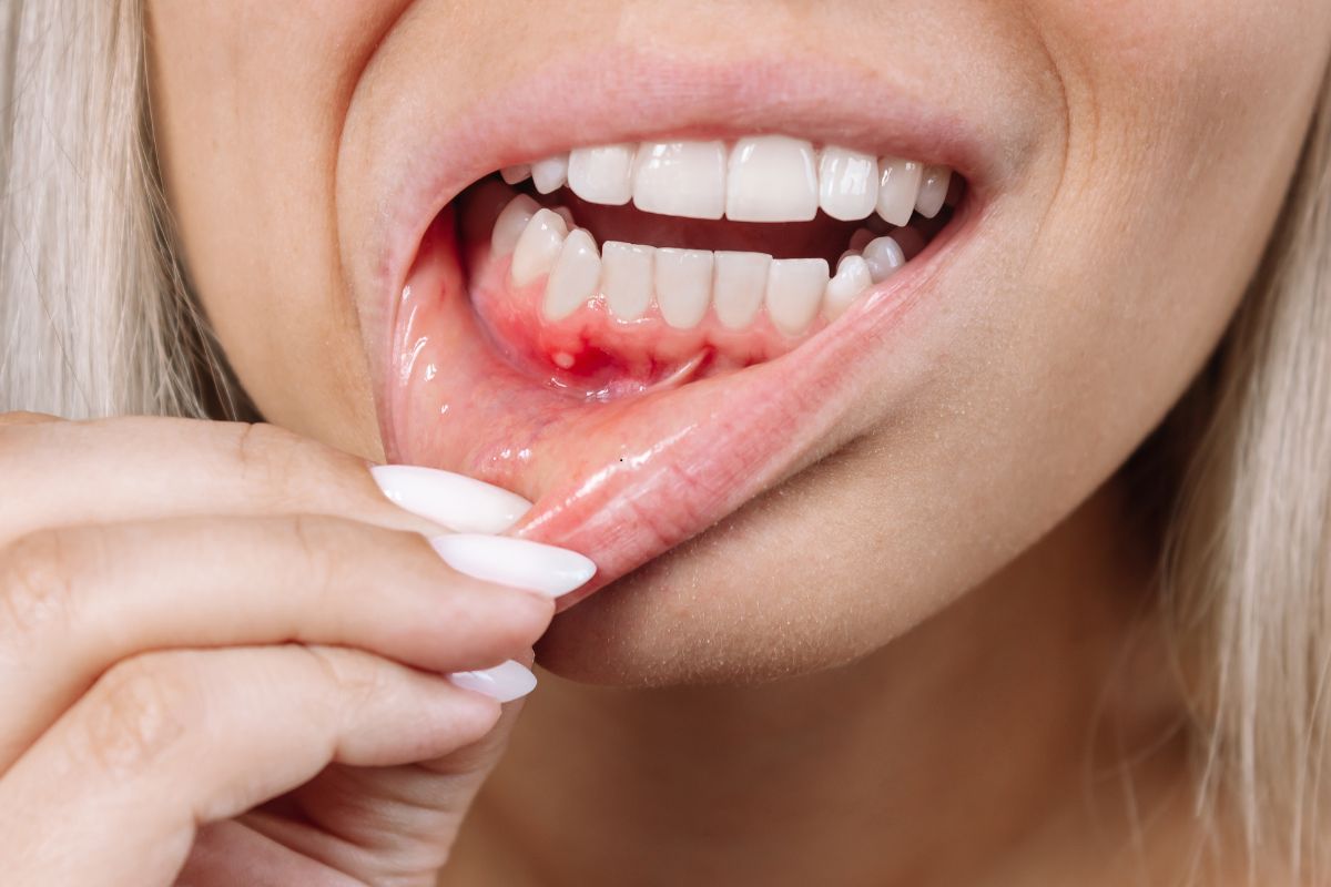 dentist in Silver Spring MD