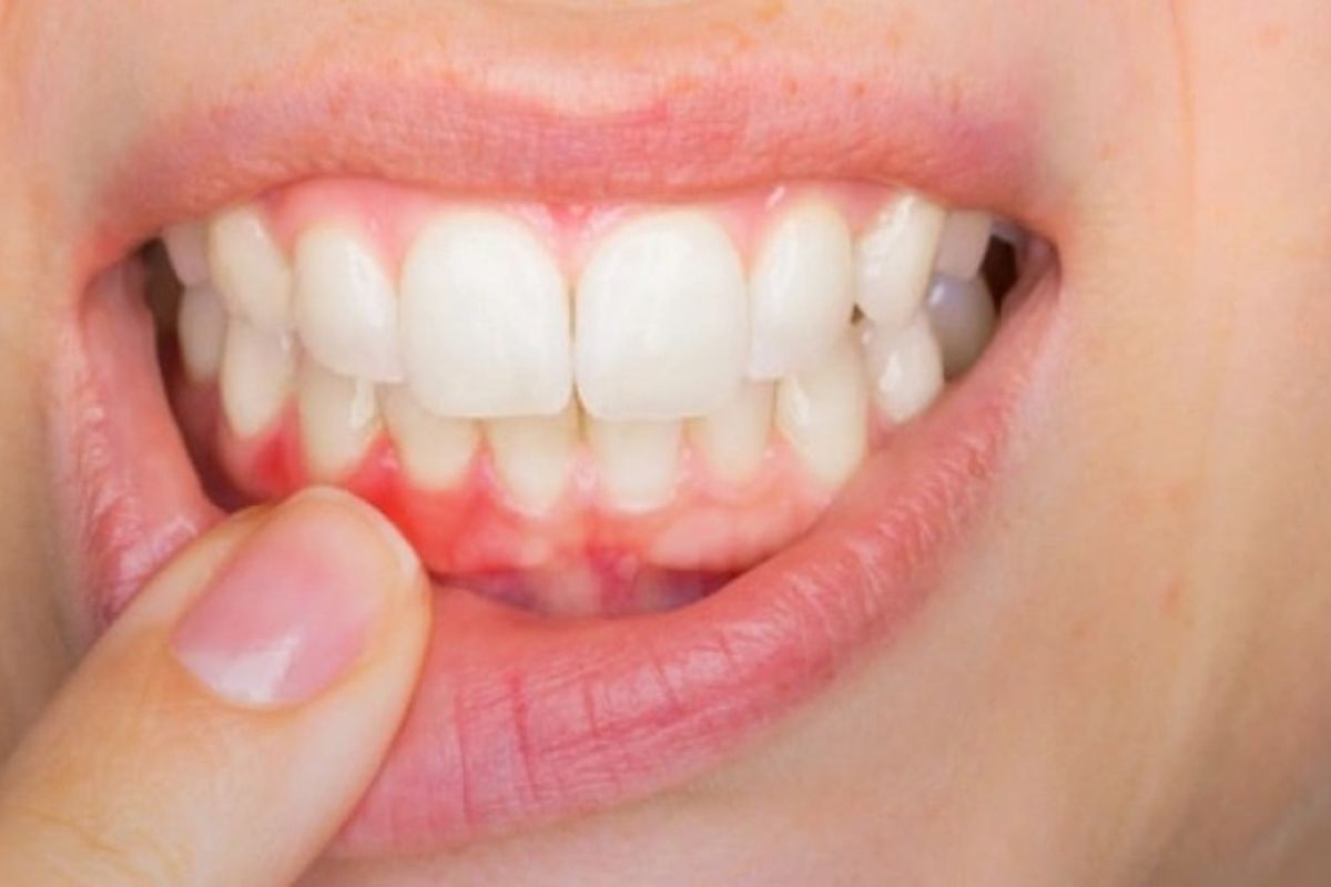 silver spring dentist