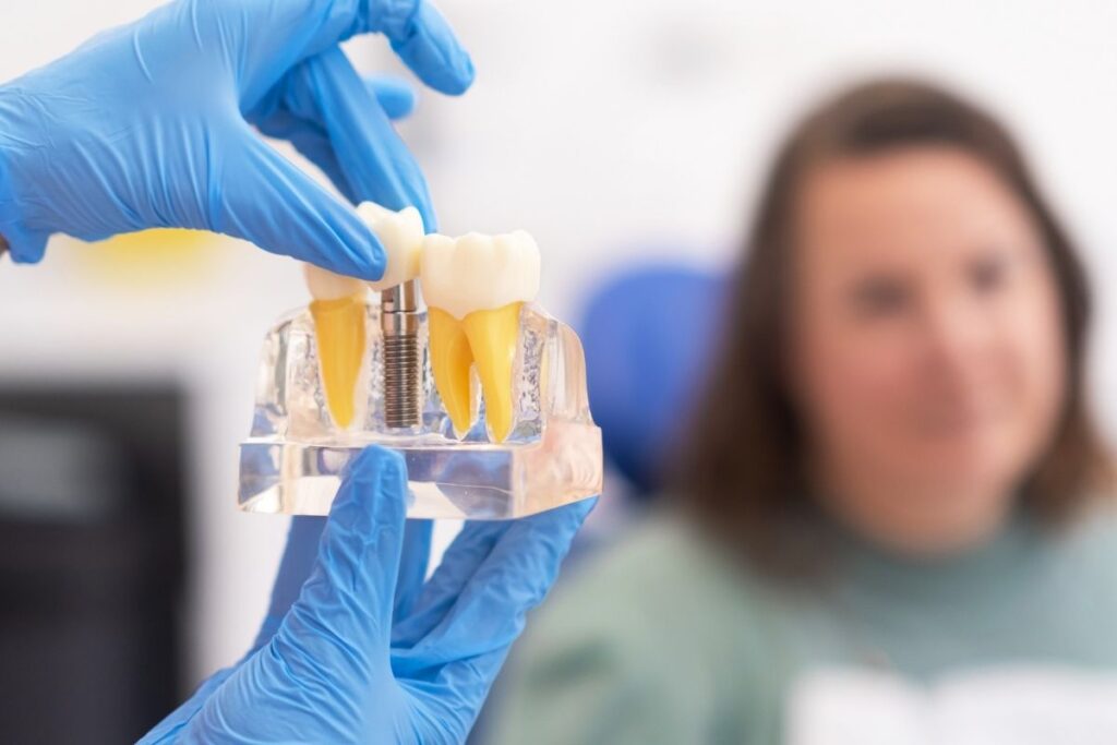 Dental implants Silver Spring